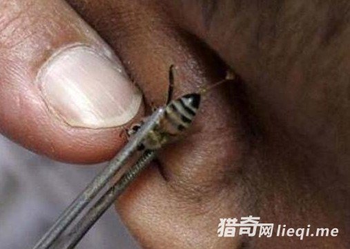 ��Щ���Ҿ�Ȼ���������ķ����β�����Щƫ���β���ҳ�����(1)