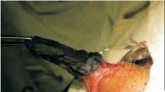 �ս������Ƭ���Ĵ����񺣱�ץ����Ѫ�޹�